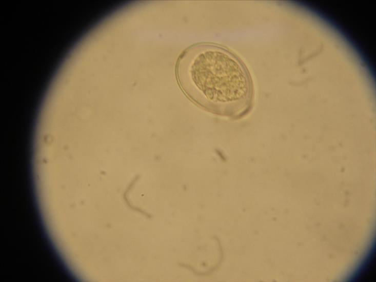 Parazytologia - diphyllobothrium latum jajo.jpg